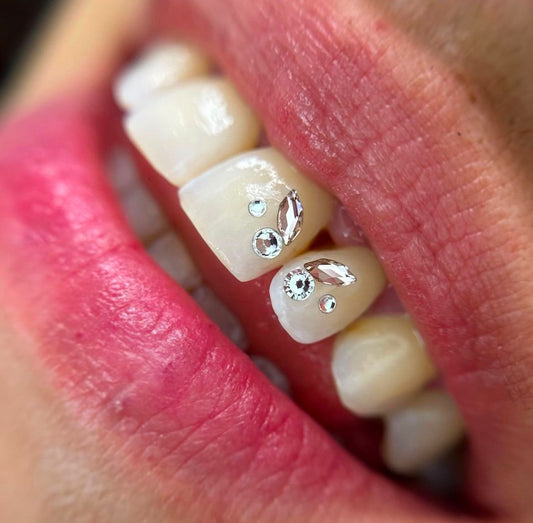 FORMACIÓN GEMAS DENTALES