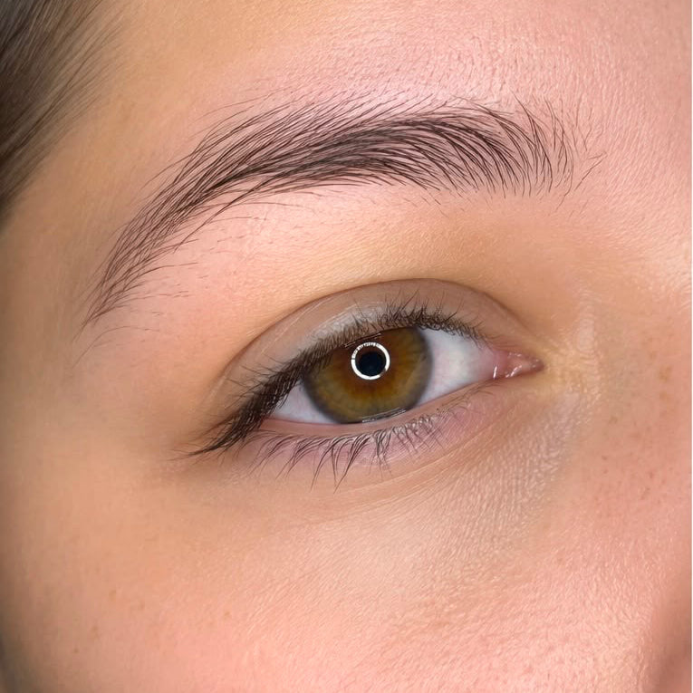 Antes