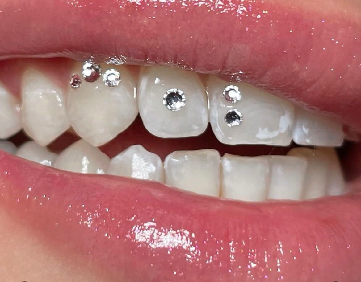 FORMACIÓN GEMAS DENTALES