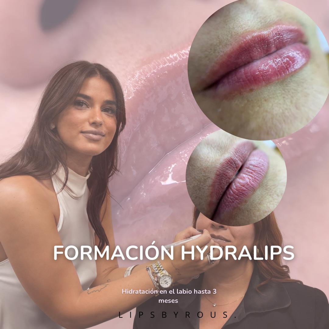 FORMACIÓN HYDRALIPS